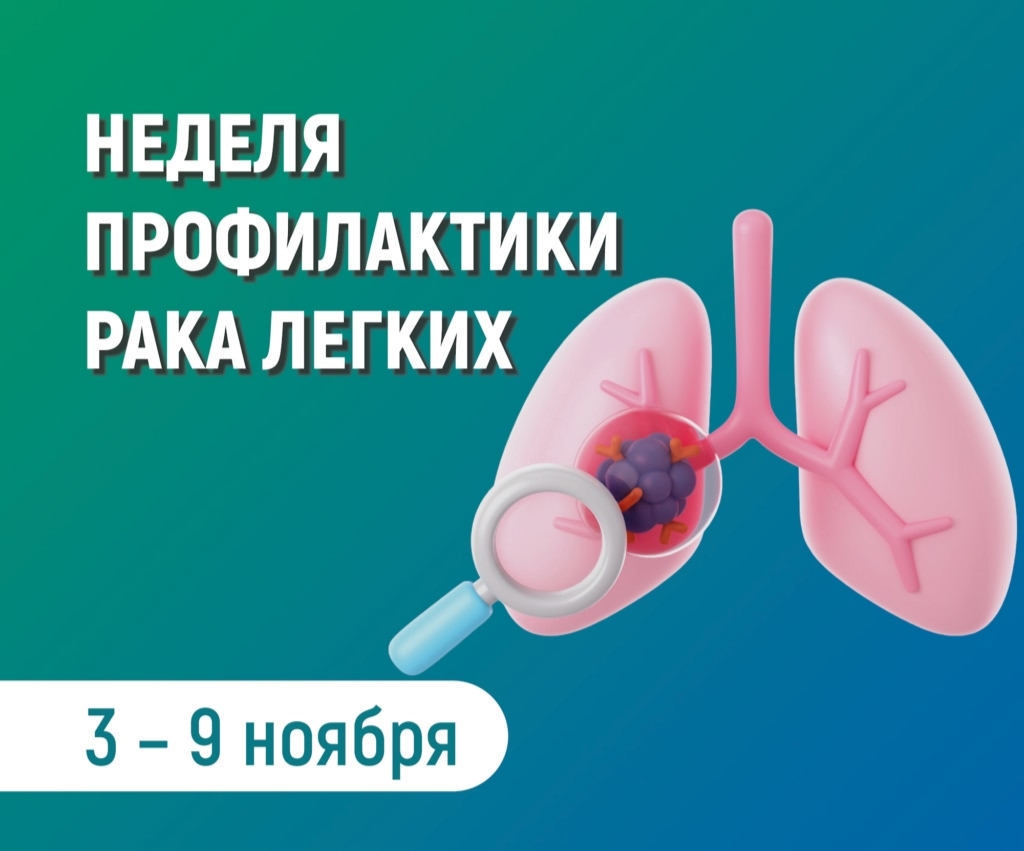 БЕРЕГИТЕ ЛЁГКИЕ!