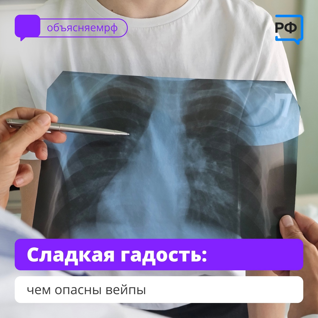 ВЕЙПЫ: ОПАСНАЯ ИЛЛЮЗИЯ БЕЗОПАСНОСТИ